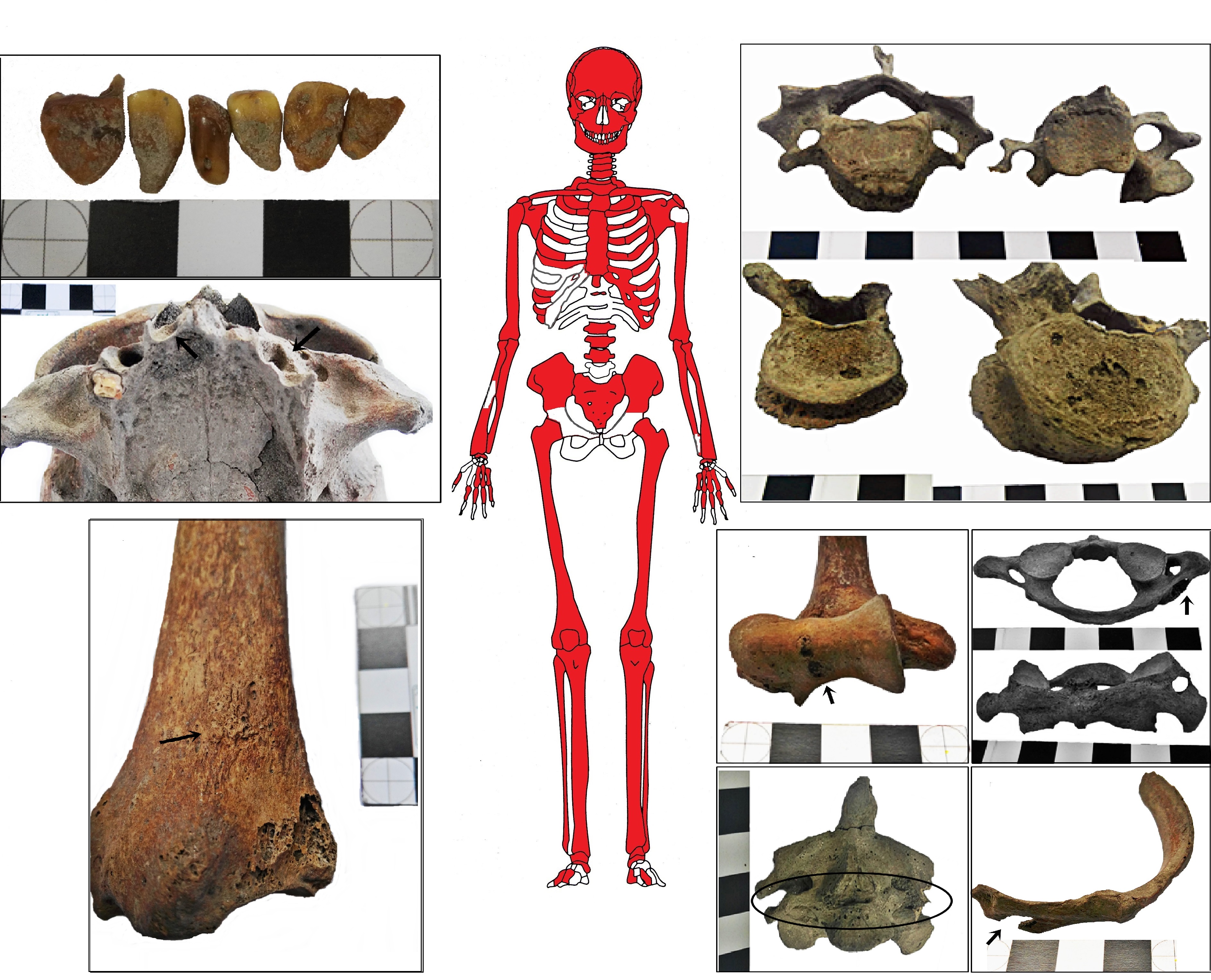 Esquema gráfico con los elementos anatómicos identificados. En detalle se observan fotografías de distintos análisis realizados. 